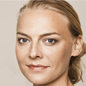 Skin Booster - After