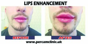 Lip13