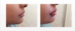 Lip32