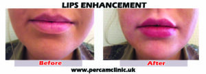 Lips21 tif
