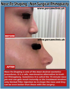 Nose Reshaping